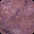 Purple Encrusting Sponge